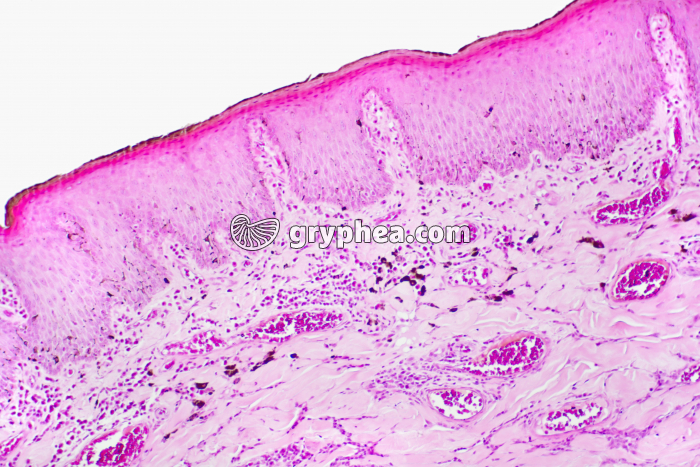 Peau de mammifère avec réaction inflammatoire x40 - gryphea.org
